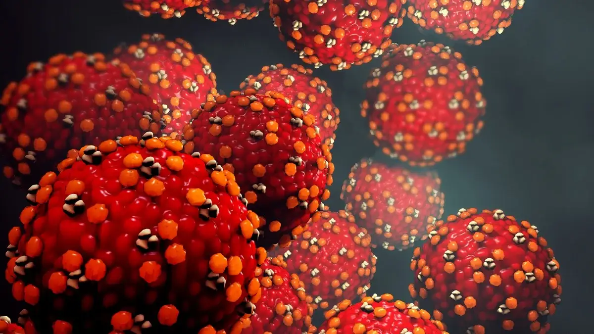 measles breakout